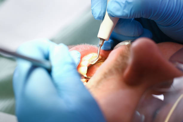 Best Emergency Treatment for Toothache in Munsey Park, NY